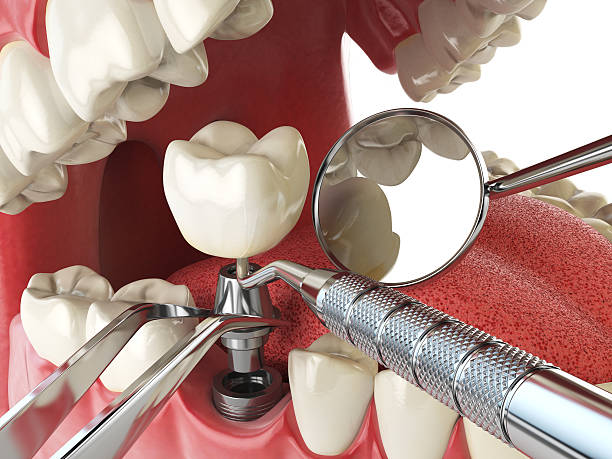Best Emergency Dental Services for Seniors in Vineyards, FL